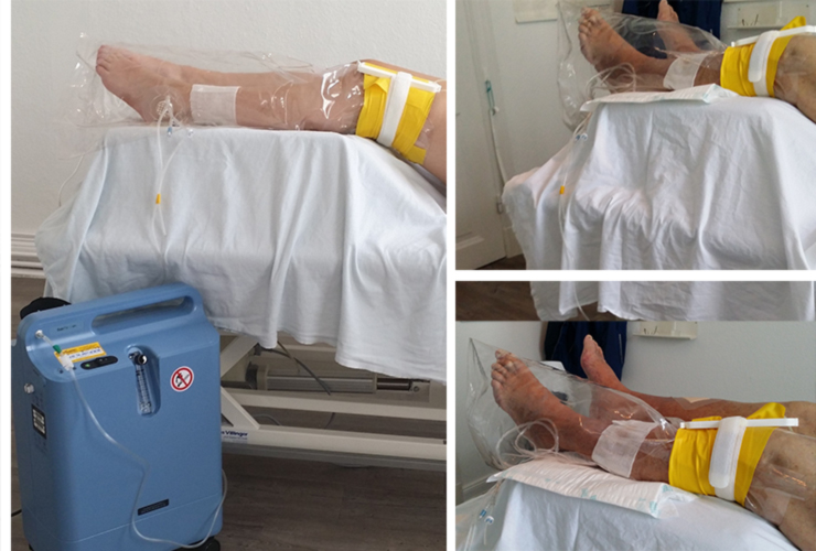 Sauerstofftherapie Sauerstofftherapie